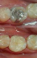 Los Angeles Cosmetic Dentist